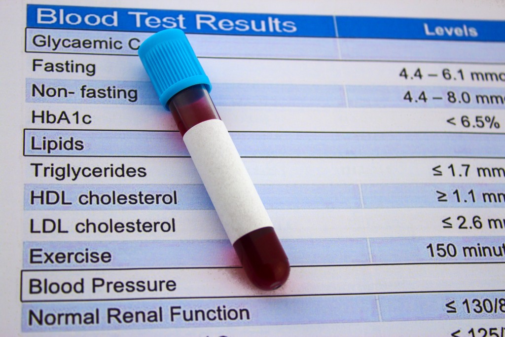 How Long To Fast For Lipid Panel Blood Test